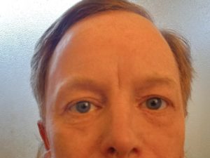 Skin care results: face after applying the product