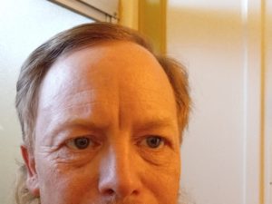 Skin care results: face before applying the product